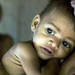 identification of sam children a timely move community management vital cmam association
